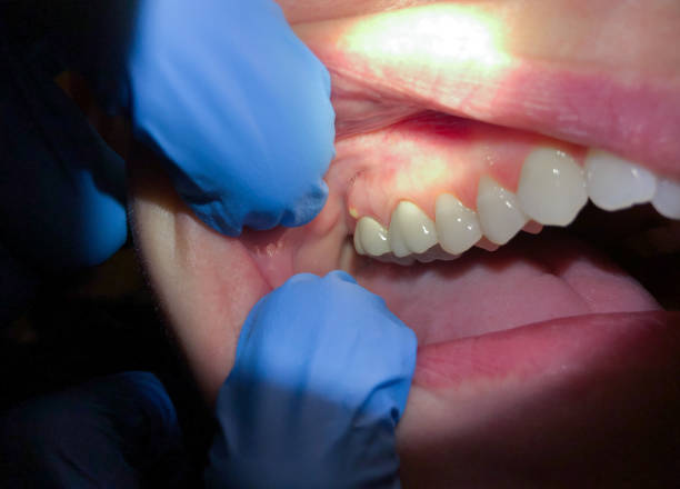 Best Mobile Emergency Dentist in New Waverly, TX