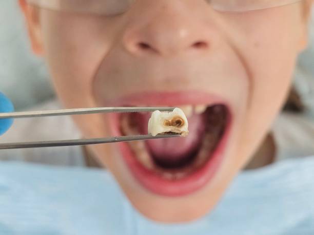 Best Mobile Emergency Dentist in New Waverly, TX
