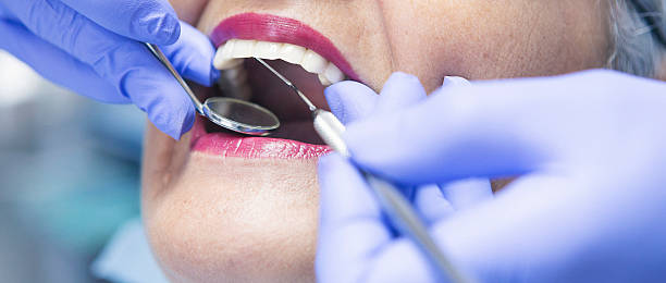 Best Emergency Root Canal Treatment in New Waverly, TX