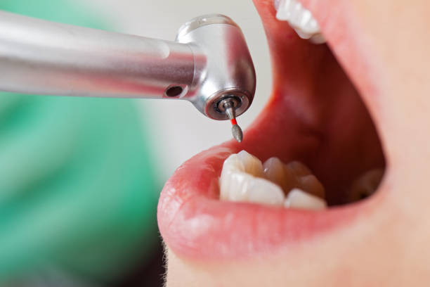 Best Pediatric Emergency Dentist in New Waverly, TX